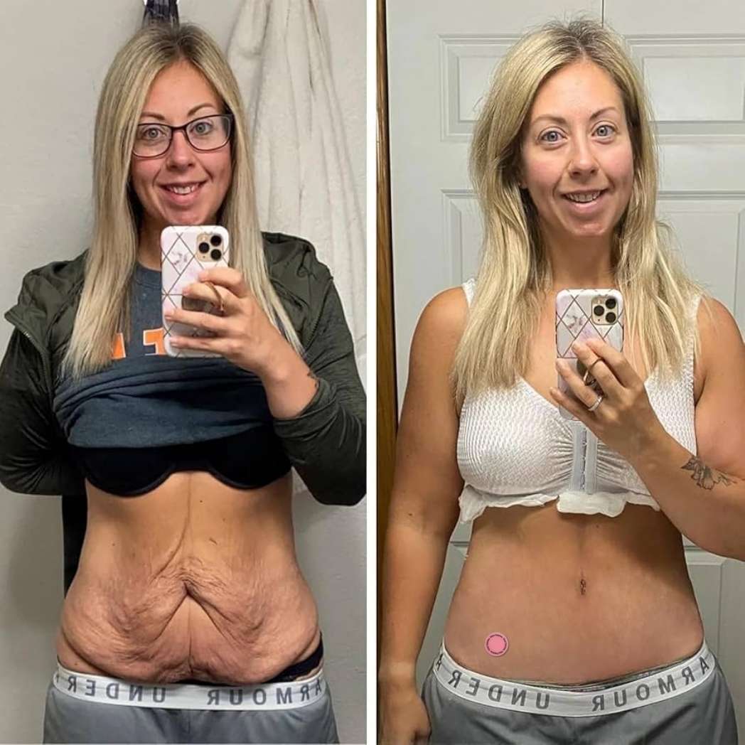Comparativa antes y después compartida por una clienta