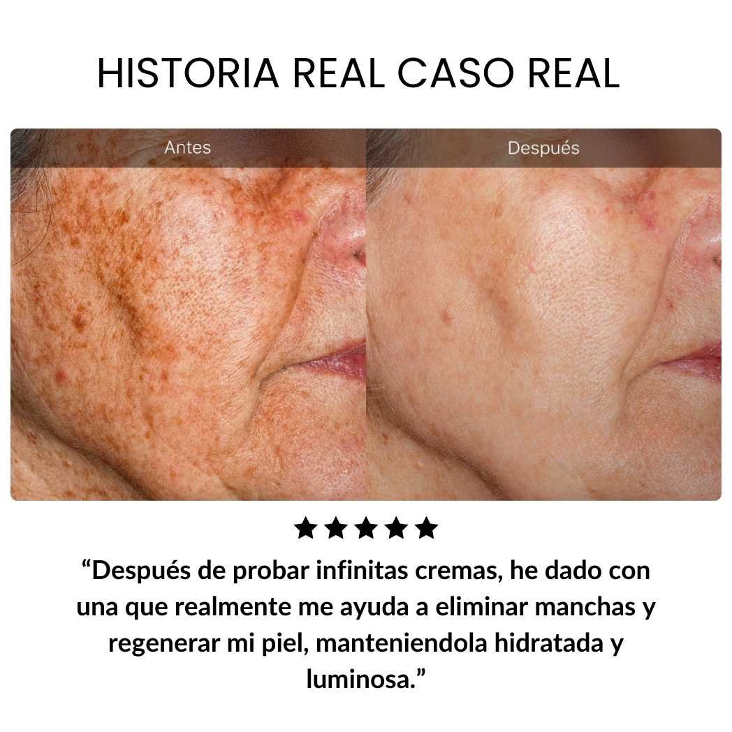 Rejuvenece +10 Años Retinol Dragon Blood